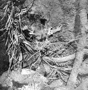 Photograph of body part